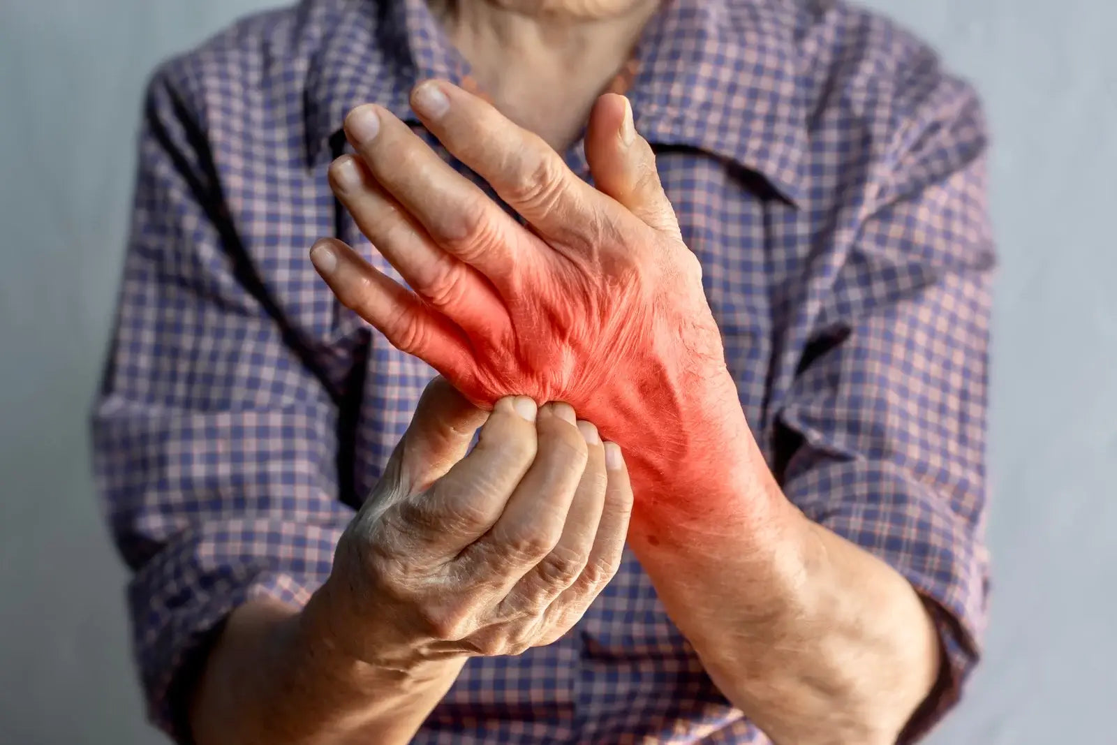 Een man die last heeft van jeuk en als gevolg daarvan een rode hand heeft.